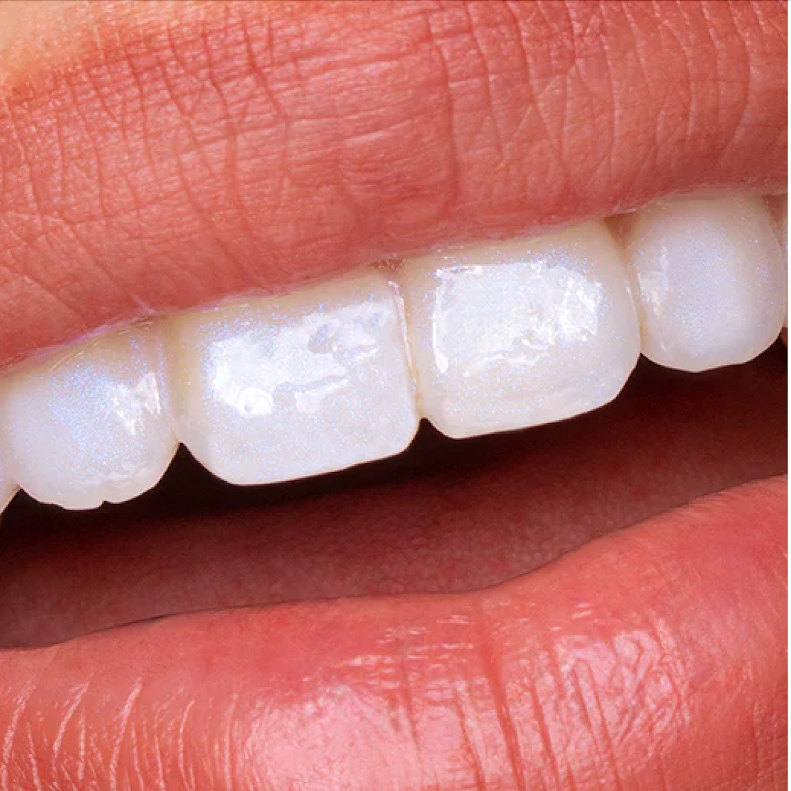 HiSmile Tooth Gloss - Glostik