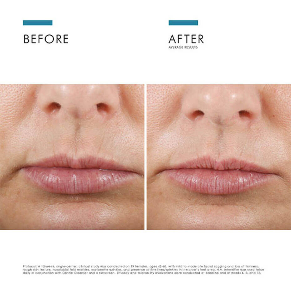 H.A. (Hyaluronic Acid) Intensifier Serum