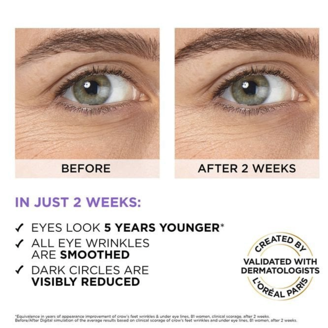 Hyaluron Expert Eye Serum - 20ml