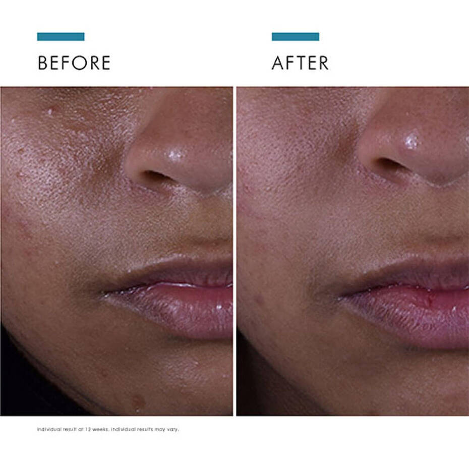 Silymarin CF Vitamin C Antioxidant Serum