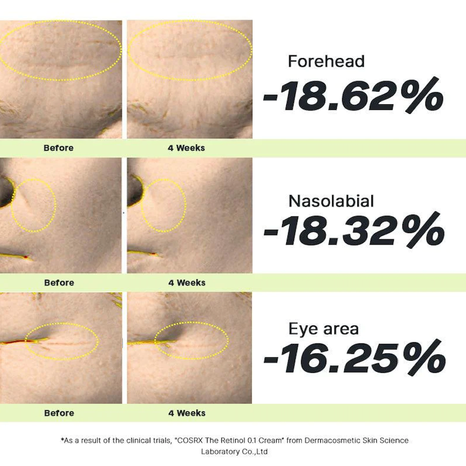 The Retinol 0.1 Cream